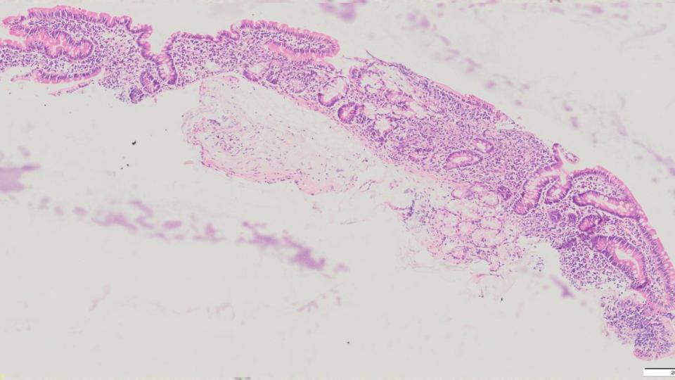 Microscopic close up of a finger-like villi in a small intestine