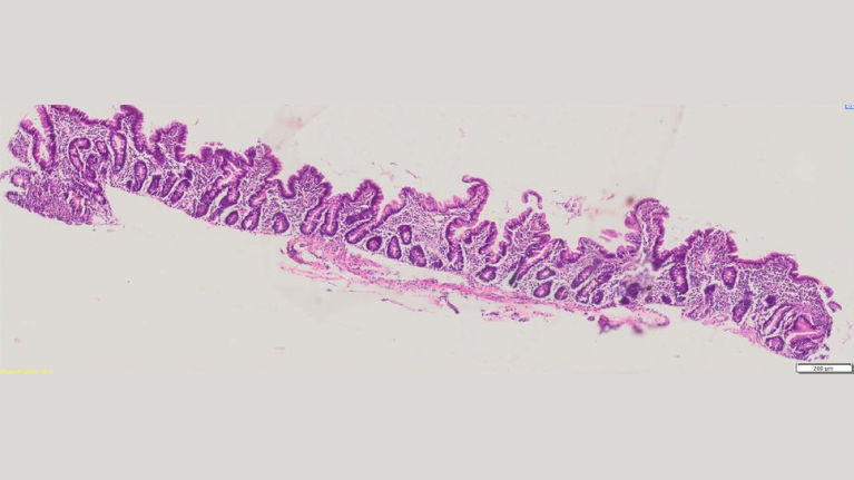 Cross section of small intestine showing gut villi regeneration following treatment with bovine colostrum.
